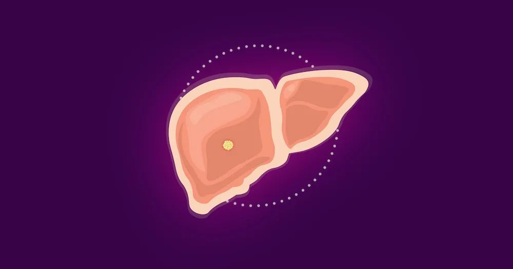 聖諾醫藥發表論文，揭示多肽納米顆粒遞送雙重siRNA，增強肝癌治療效果