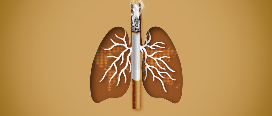 肺部結節與血管之間的關系：癌細胞如何依靠血管生長？